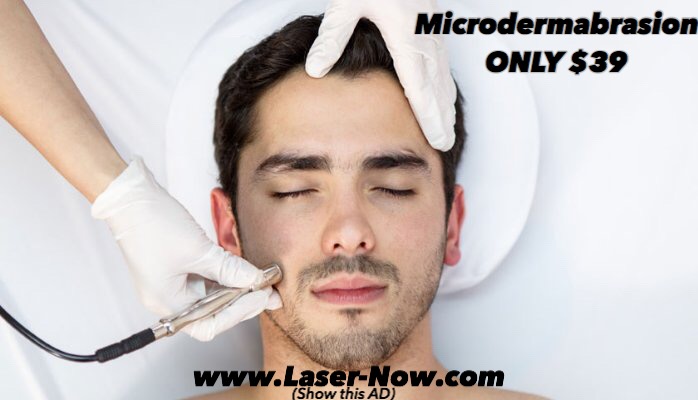 Laser Now Ad, Chris Ryan, microdermabrasion, skin beauty